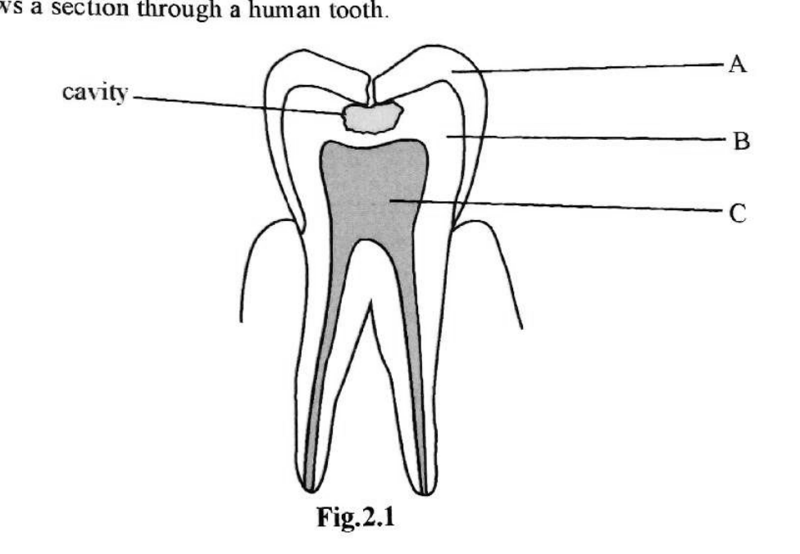 Teeth and dental decay - ZIMSEC Biology past paper diagram