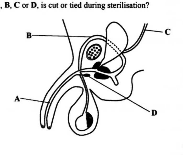 Diagram for Combined Science Paper 1 June 2024 Question 11