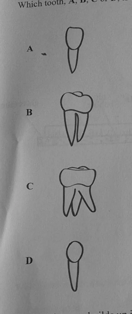 Diagram for Combined Science Paper 1 November 2024 Question 4